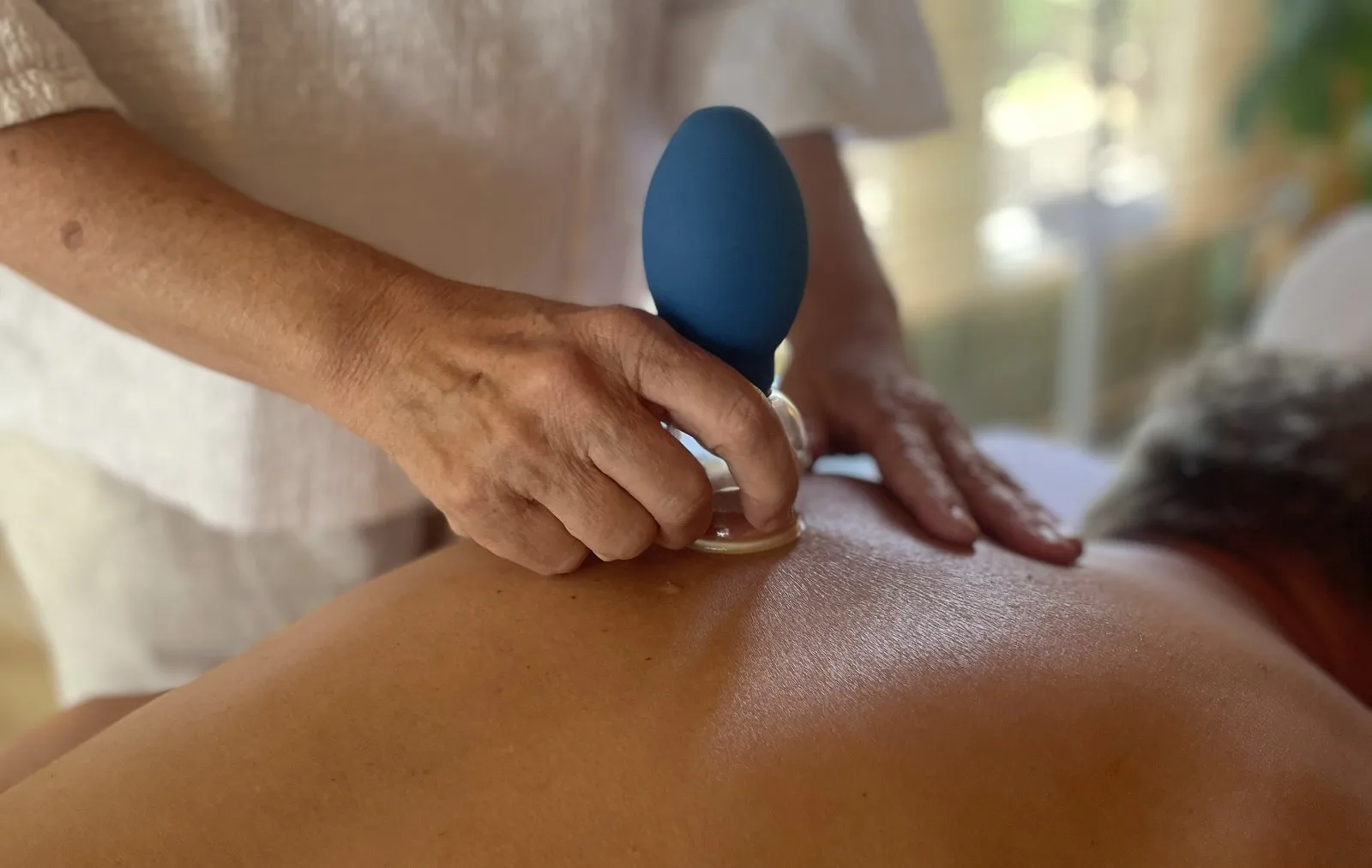 Transformational Cupping behandeling met moving cups in Etten-Leur