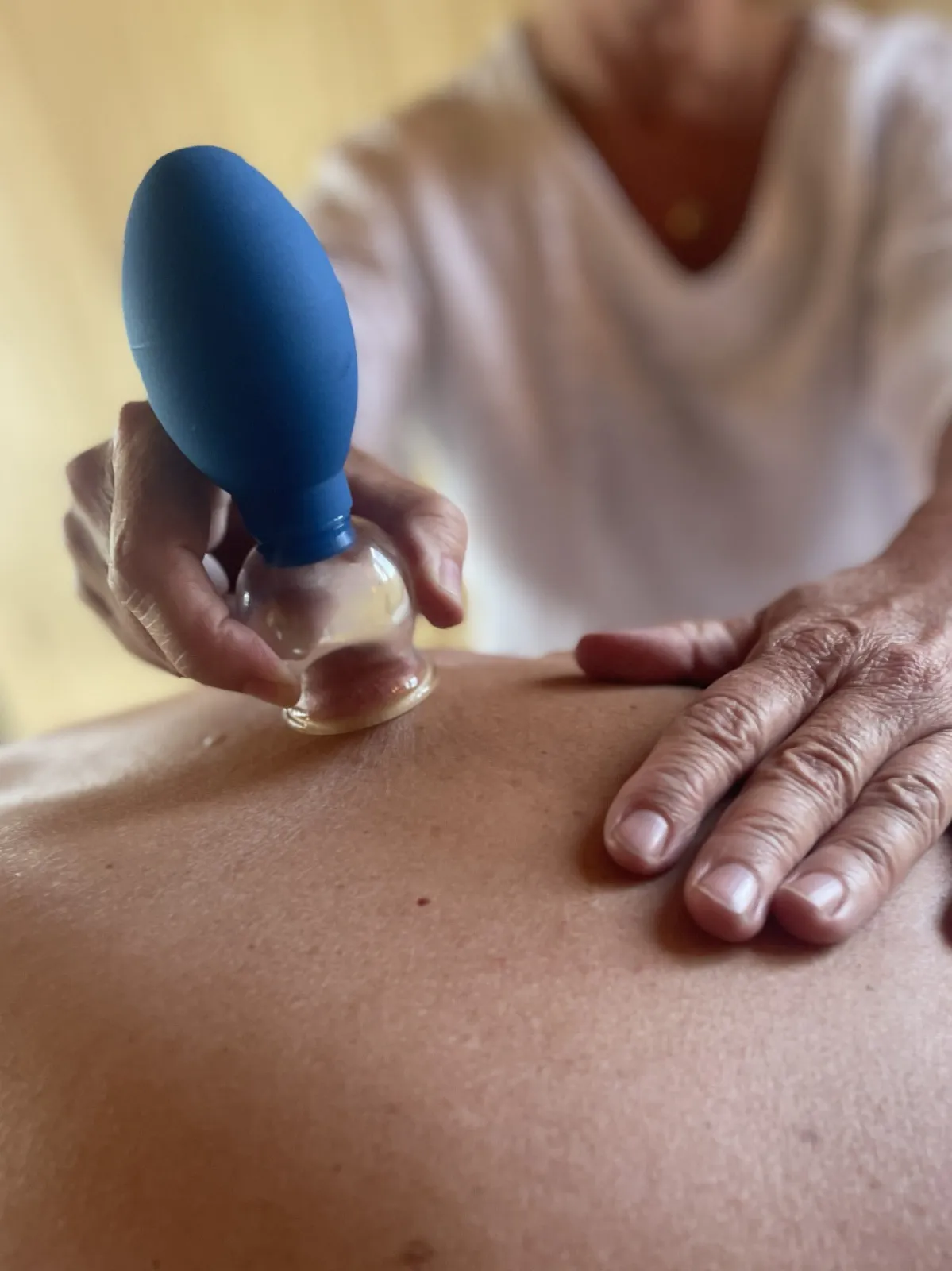 Cupping op de rug bij Cupping Etten-Leur