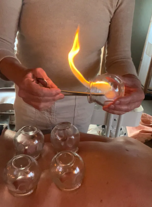Vuurcupping in Etten-Leur